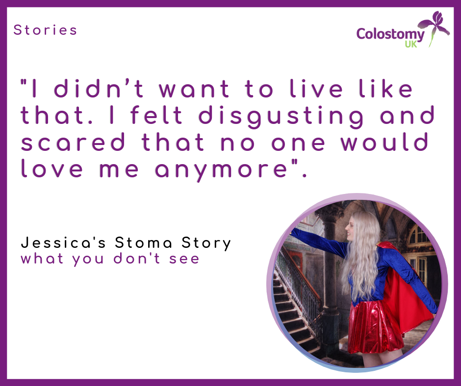 Jessica’s Stoma Story: what you don’t see