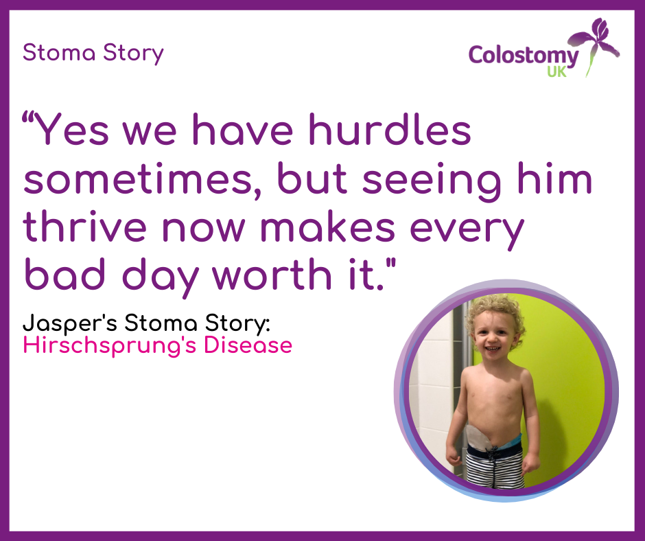 Jasper’s Stoma Story: Hirschsprung’s Disease