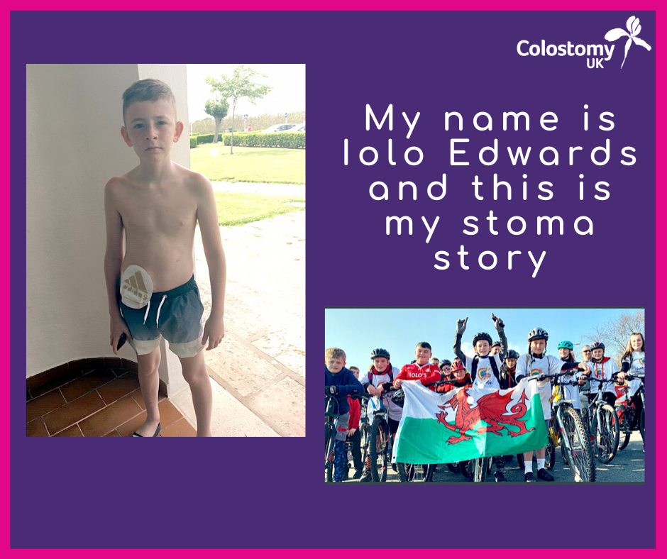 My name is Iolo Edwards and this is my stoma story