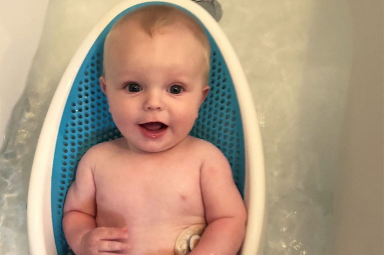 Caring for a baby with a stoma Colostomy UK