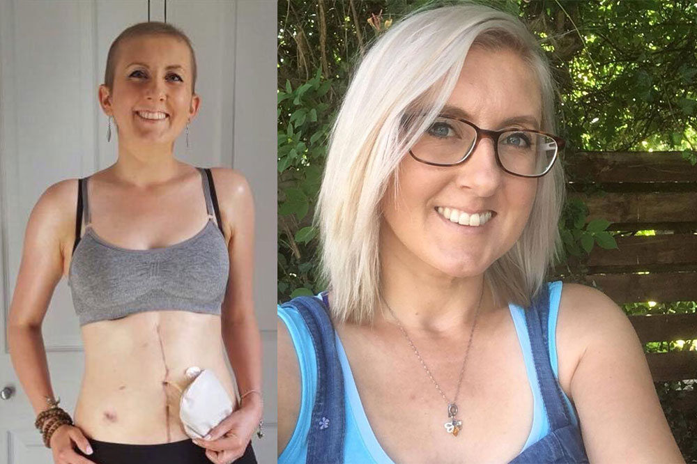 World Ovarian Cancer Day – Fiona Munro’s Story