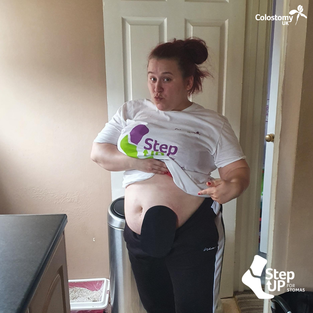 Meet Emma – One of our Step Up For Stomas Hero’s
