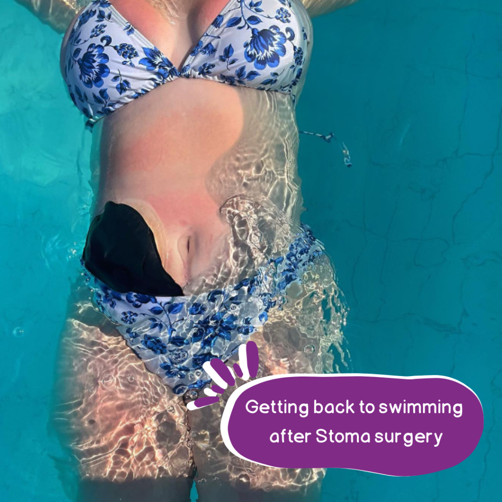 Swimming - Colostomy UK