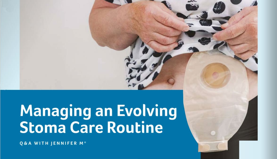 Managing an Evolving Stoma Care Routine