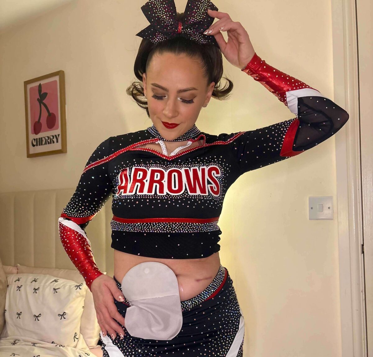 After years of living with ulcerative colitis, Georgie shares how stoma surgery not only gave her her life back, but also helped her find confidence, connection, and community during some of her loneliest moments.