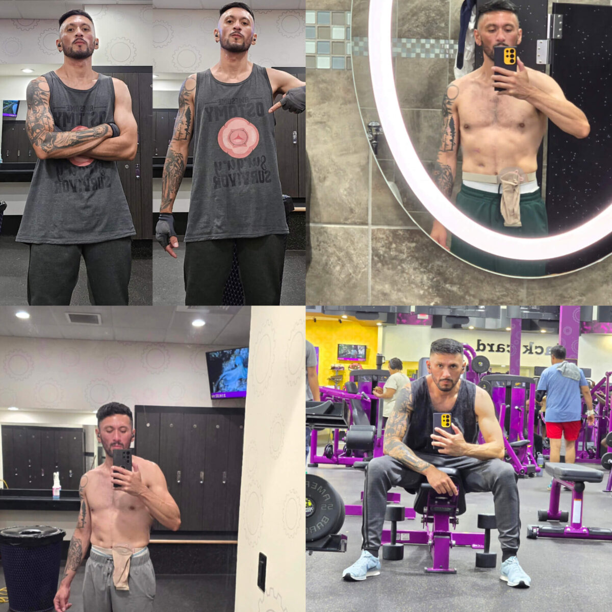 From Nicaragua to North Carolina: My Journey Through Crohn’s, Coma, and Life with an Ileostomy