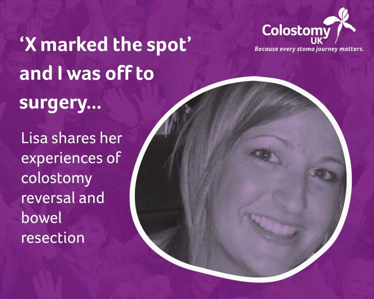 ‘X marked the spot’ and I was off to surgery...